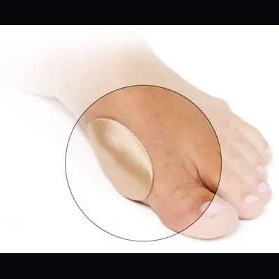 Intelligel Auto Adhesive Bunion Protector